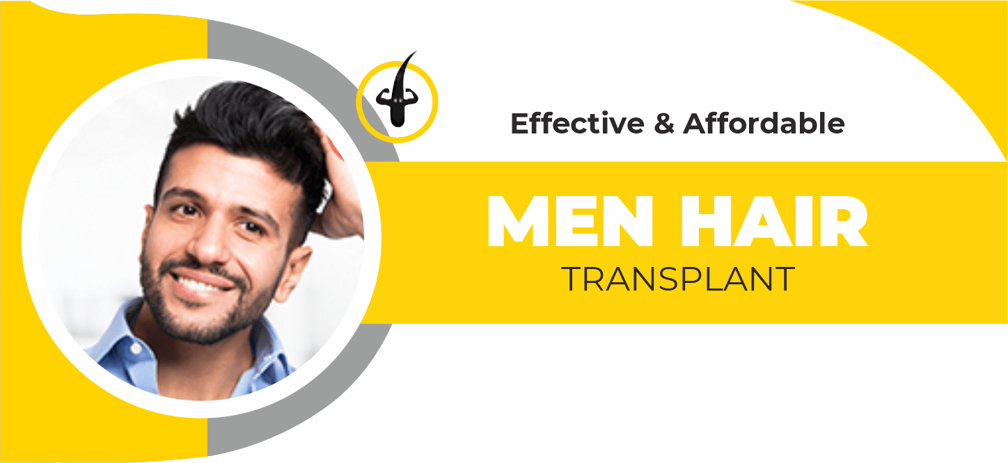 Men Hair Transplant in India